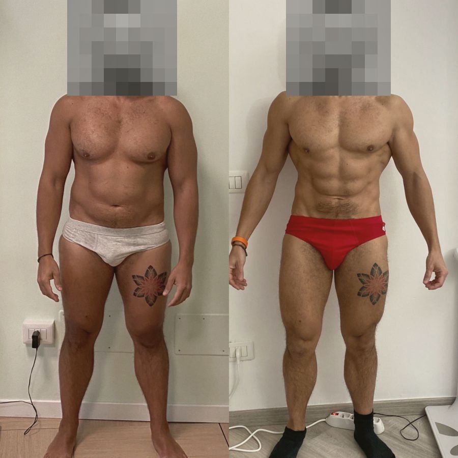 Foto prima e dopo di un paziente