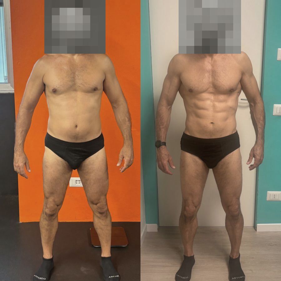 Foto prima e dopo di un paziente