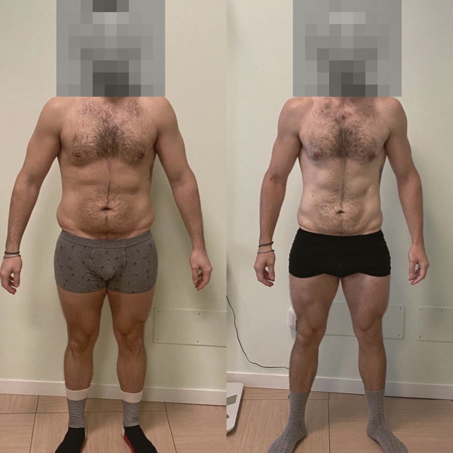 Foto prima e dopo di un paziente
