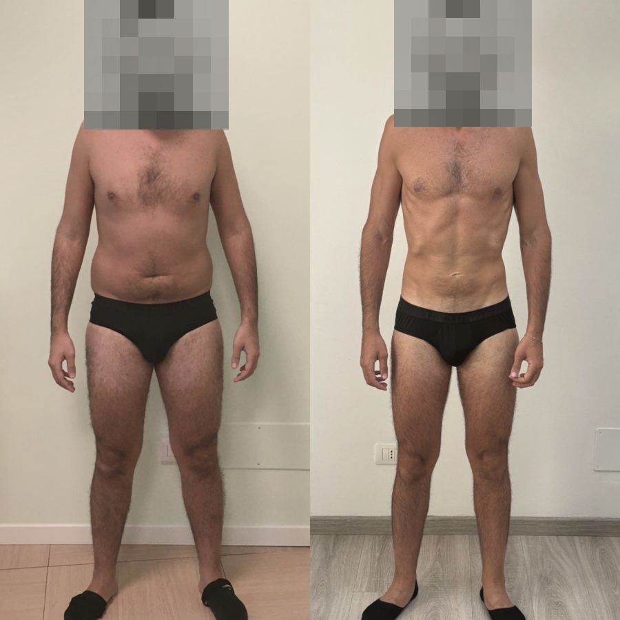 Foto prima e dopo di un paziente