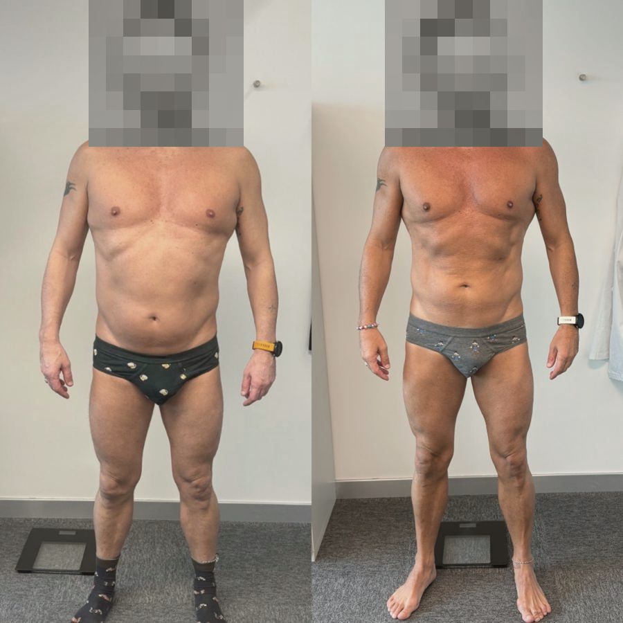 Foto prima e dopo di un paziente