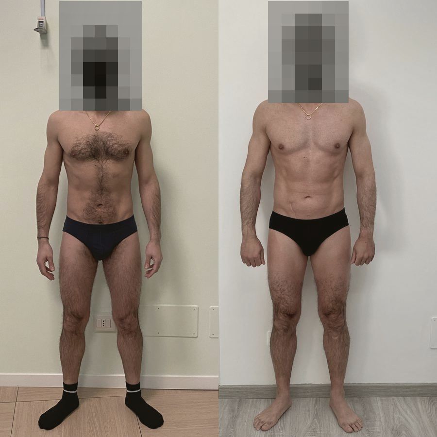 Foto prima e dopo di un paziente