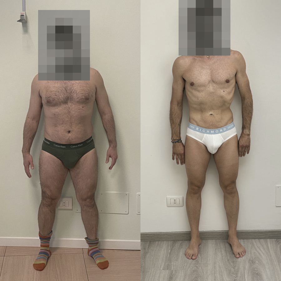 Foto prima e dopo di un paziente